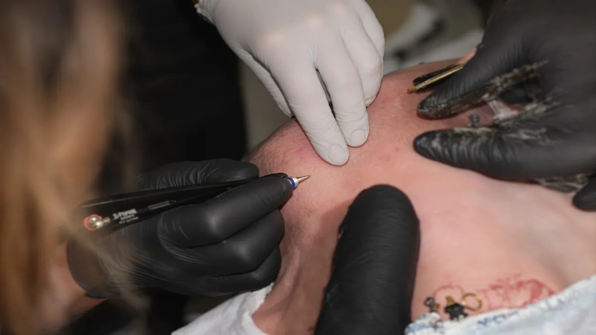 Tatouage capillaire en cours de réalisation sur un cuir chevelu.